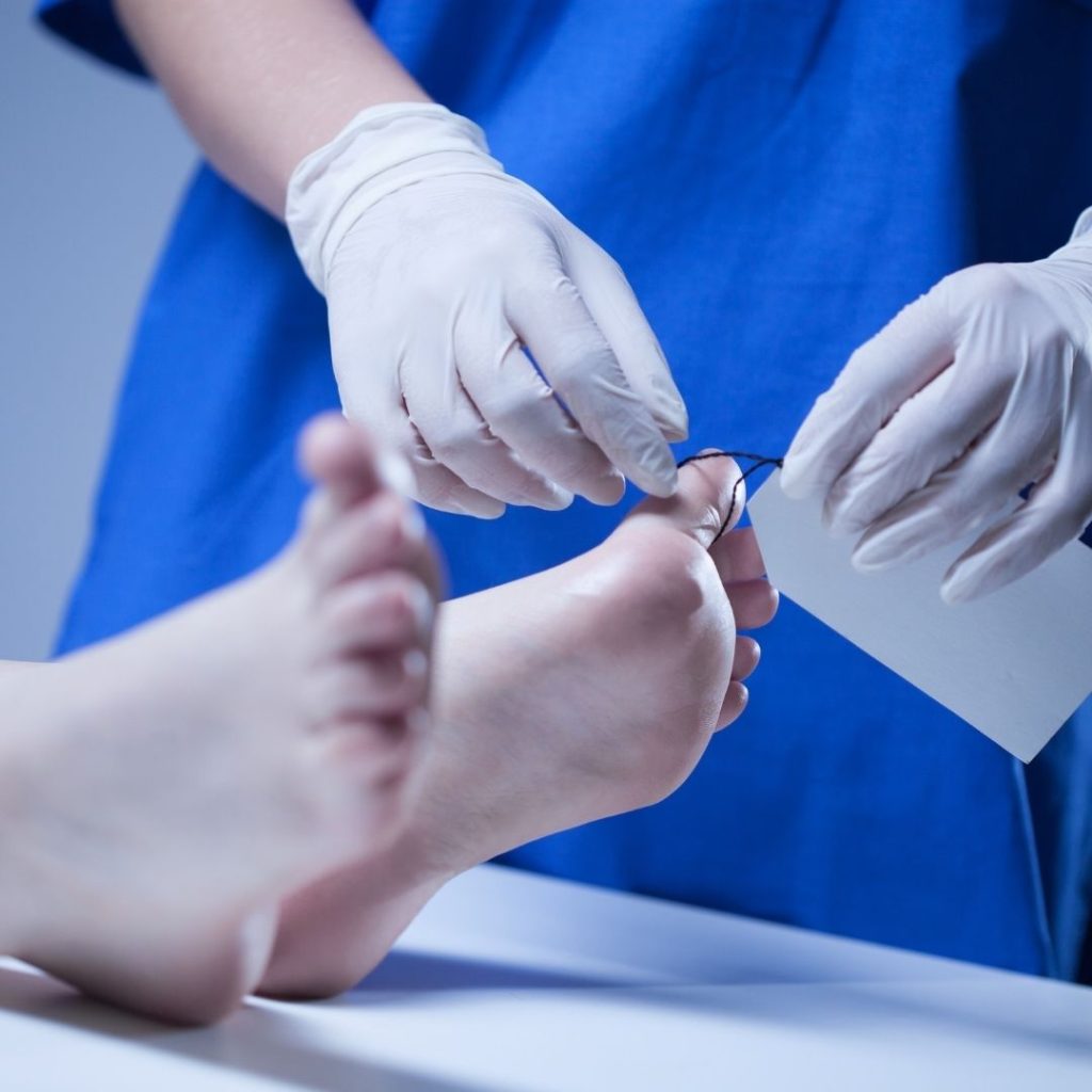 Kobayashi Pharmaceutical, menarik suplemen kesehatan Beni Koji setelah laporan kematian konsumen